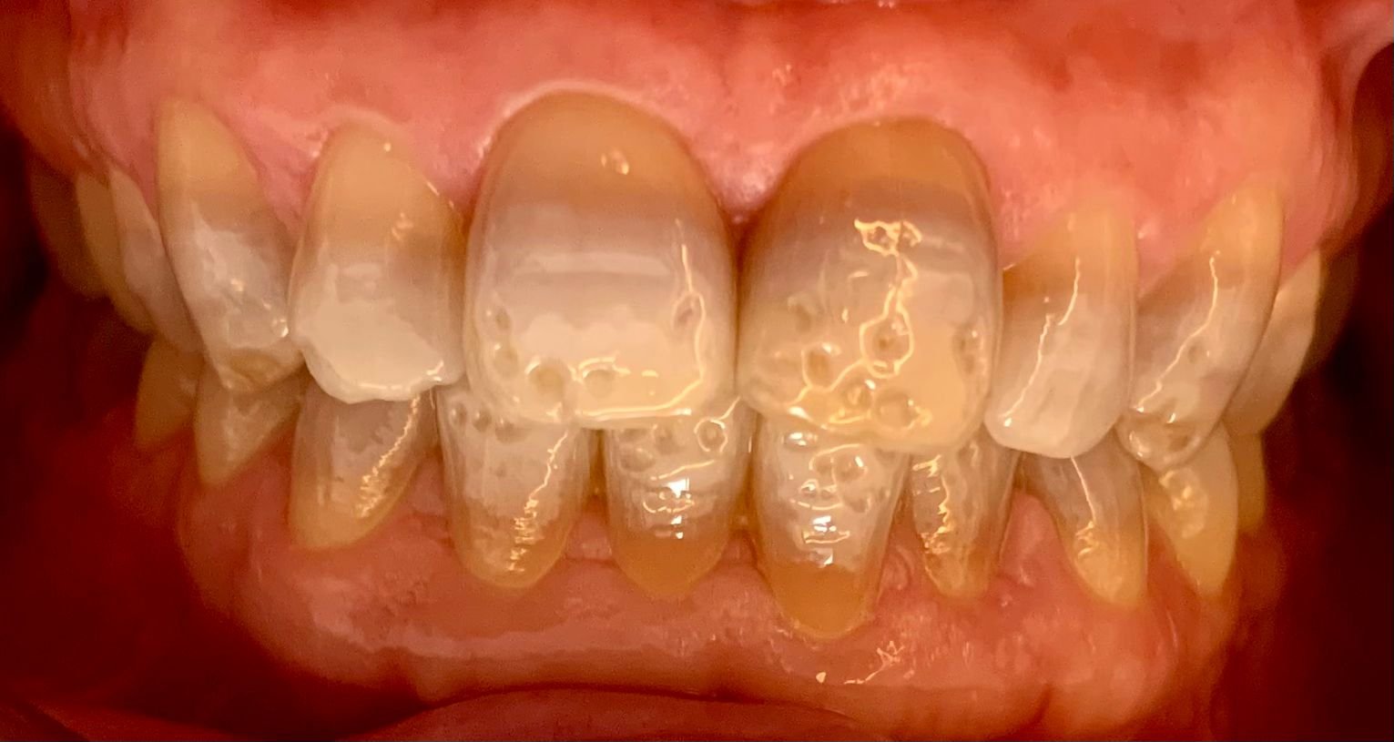 dentista león
