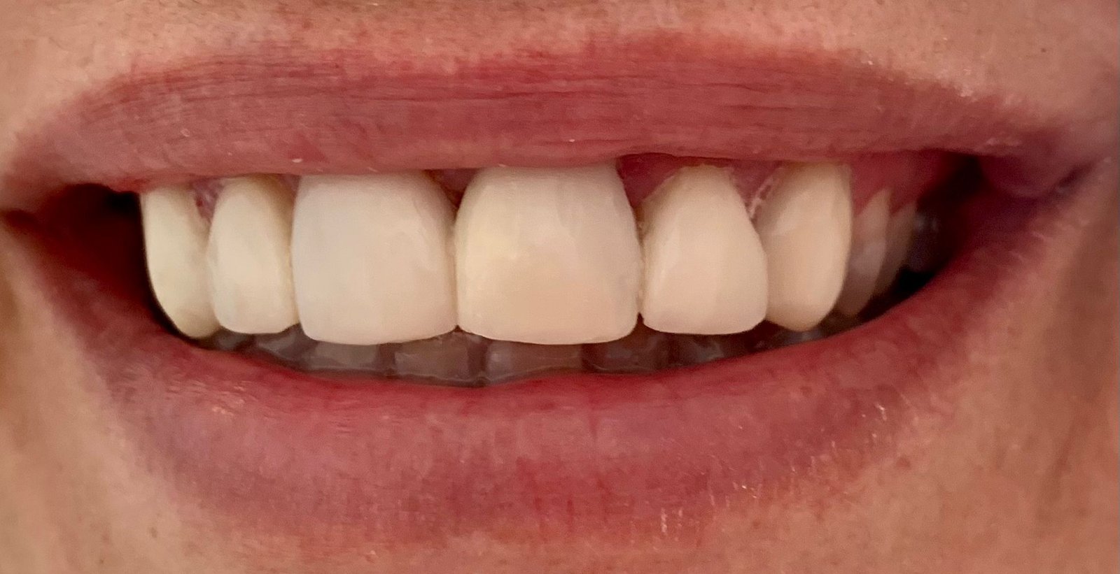 dentista en león
